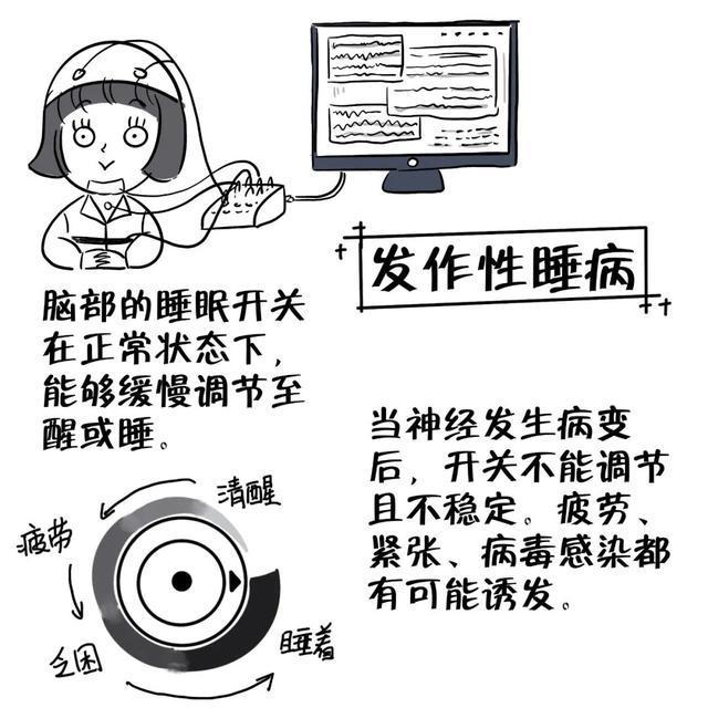 发作性睡病最新治疗进展及策略综述