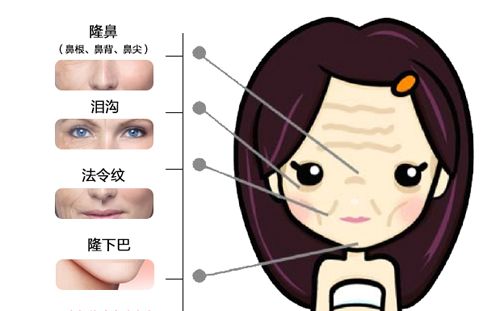 最新除皱技术，重塑青春肌肤的终极秘诀